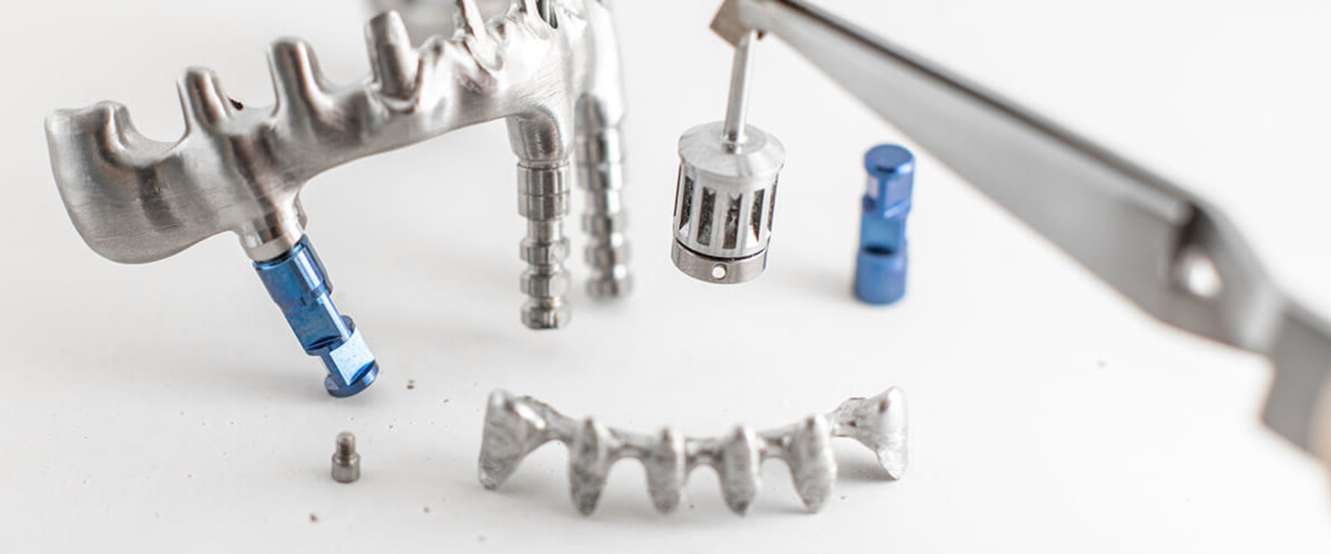 The Basics of Subperiosteal Implants for Dental Health