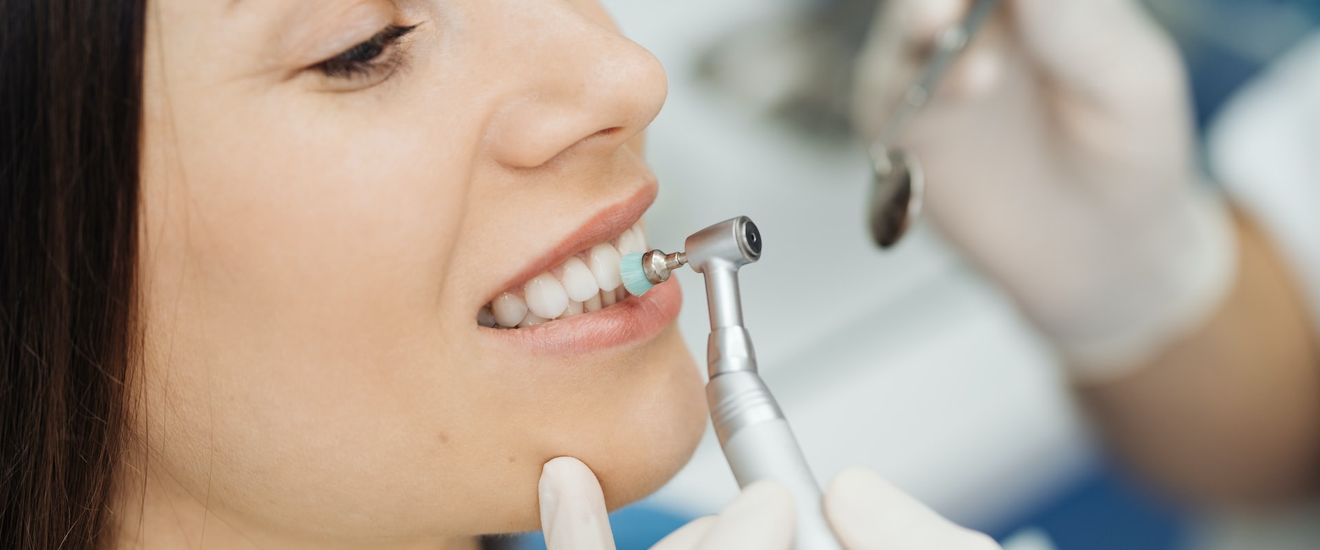 Discussing Goals and Concerns: A Comprehensive Guide to Finding a Cosmetic Dentist
