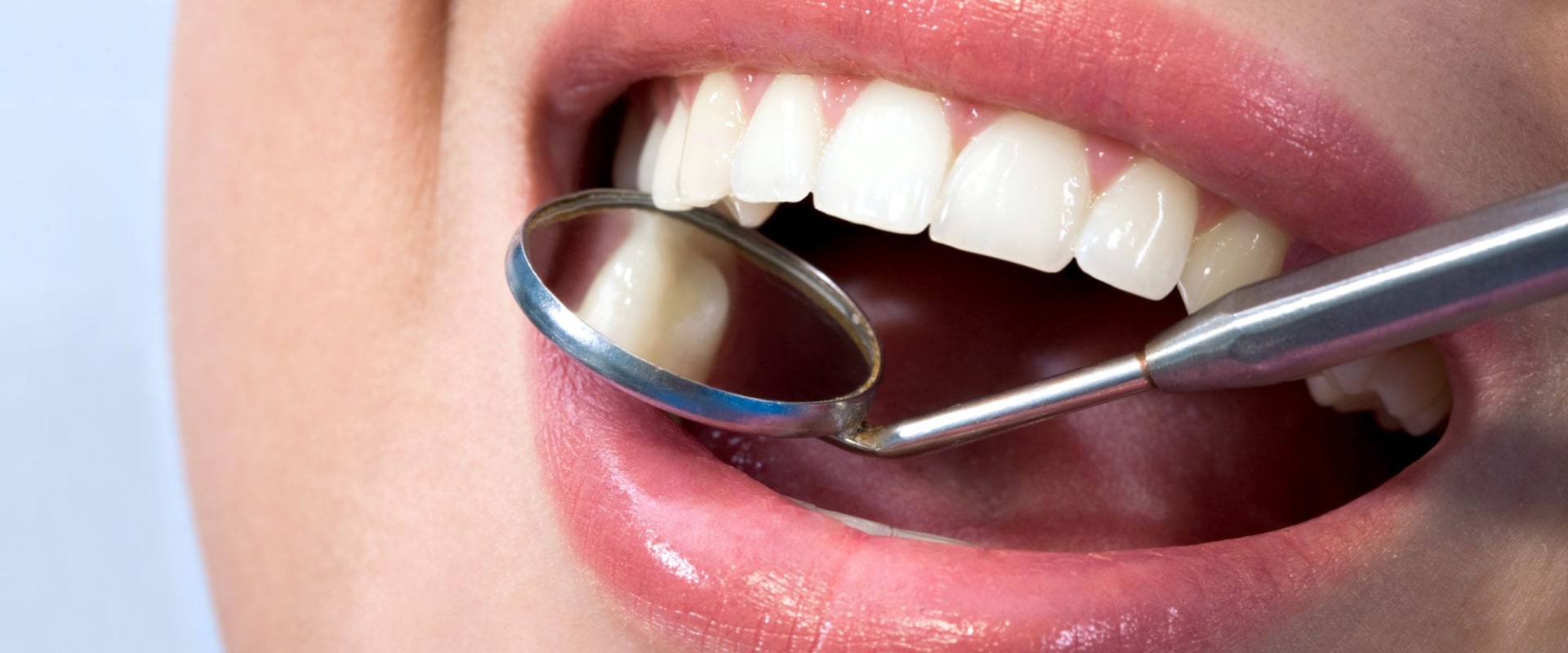 Everything You Need to Know About the Length of Treatment Time for Teeth Straightening