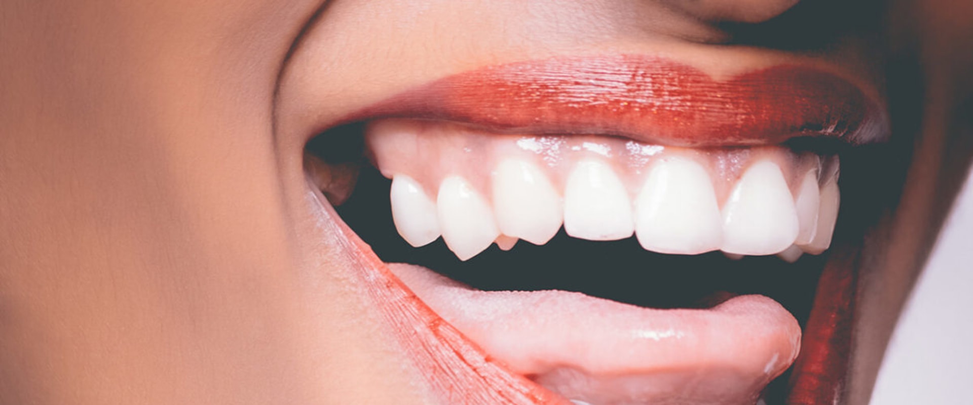 Feeling Comfortable and Confident: How to Trust Your Cosmetic Dentist