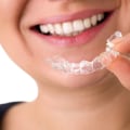 How Teeth Straightening Can Improve Your Appearance and Boost Your Confidence