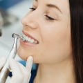 Discussing Goals and Concerns: A Comprehensive Guide to Finding a Cosmetic Dentist