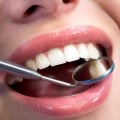 Everything You Need to Know About the Length of Treatment Time for Teeth Straightening