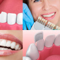 Budget and Financing Options for Your Smile Makeover