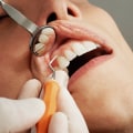 The Importance of Maintaining Results for Cosmetic Dental Procedures