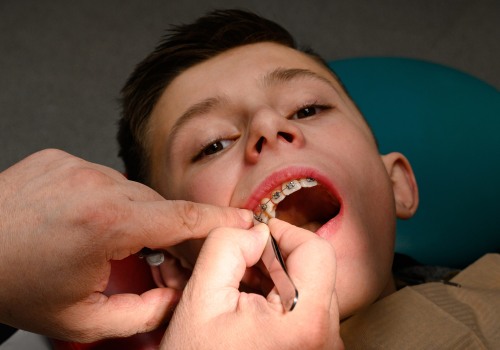 Understanding the Potential for Discomfort or Pain in Teeth Straightening