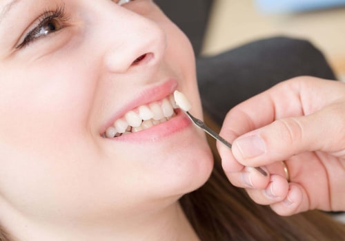 Understanding Gum Irritation and Teeth Whitening: Risks and Side Effects