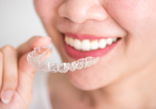 Reduced Risk of Dental Problems: The Benefits of Teeth Straightening