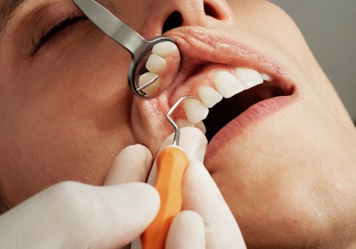 The Importance of Maintaining Results for Cosmetic Dental Procedures