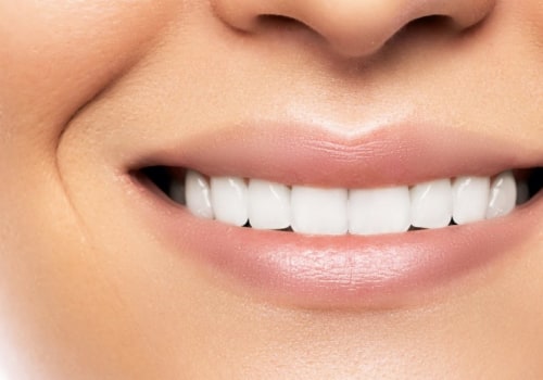 How to Achieve a Brighter and Whiter Smile: The Ultimate Guide to Teeth Whitening