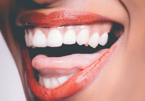 Feeling Comfortable and Confident: How to Trust Your Cosmetic Dentist